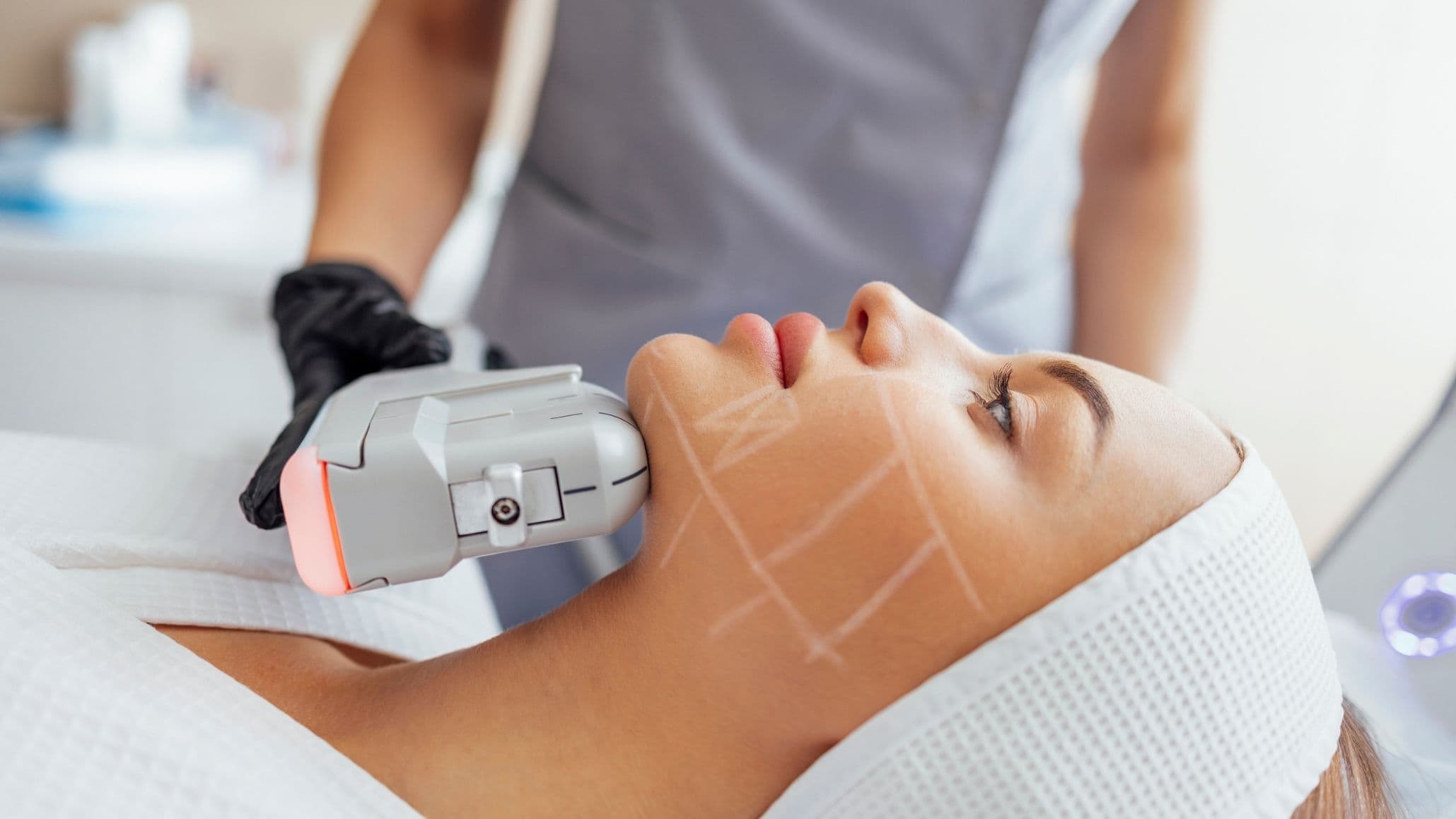 High-Intensity Focused Ultrasound  Skincare Treatment